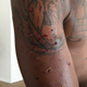 Photo showing what attorney Lee Merritt says are bite marks on Marlin Gipson’s arm (courtesy of Lee Merritt)
